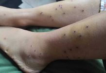 روایت دو شاهد عینی از اعتراضات دی۴۰۴ در اراک: تک تیراندازها فقط سر جوانترها را نشانه میگرفتند