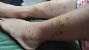 روایت دو شاهد عینی از اعتراضات دی۴۰۴ در اراک: تک تیراندازها فقط سر جوانترها را نشانه میگرفتند