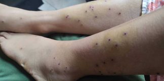 روایت دو شاهد عینی از اعتراضات دی۴۰۴ در اراک: تک تیراندازها فقط سر جوانترها را نشانه میگرفتند