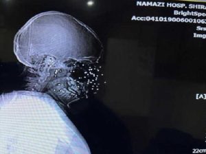 گزارش گاردین از هدفگيرى عامدانه به صورت، سینه و اندام تناسلی معترضان در ایران